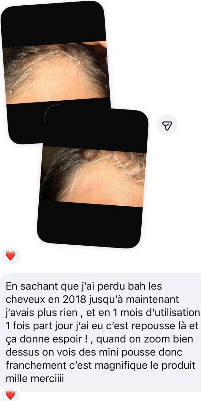 Message privé · 1 mois