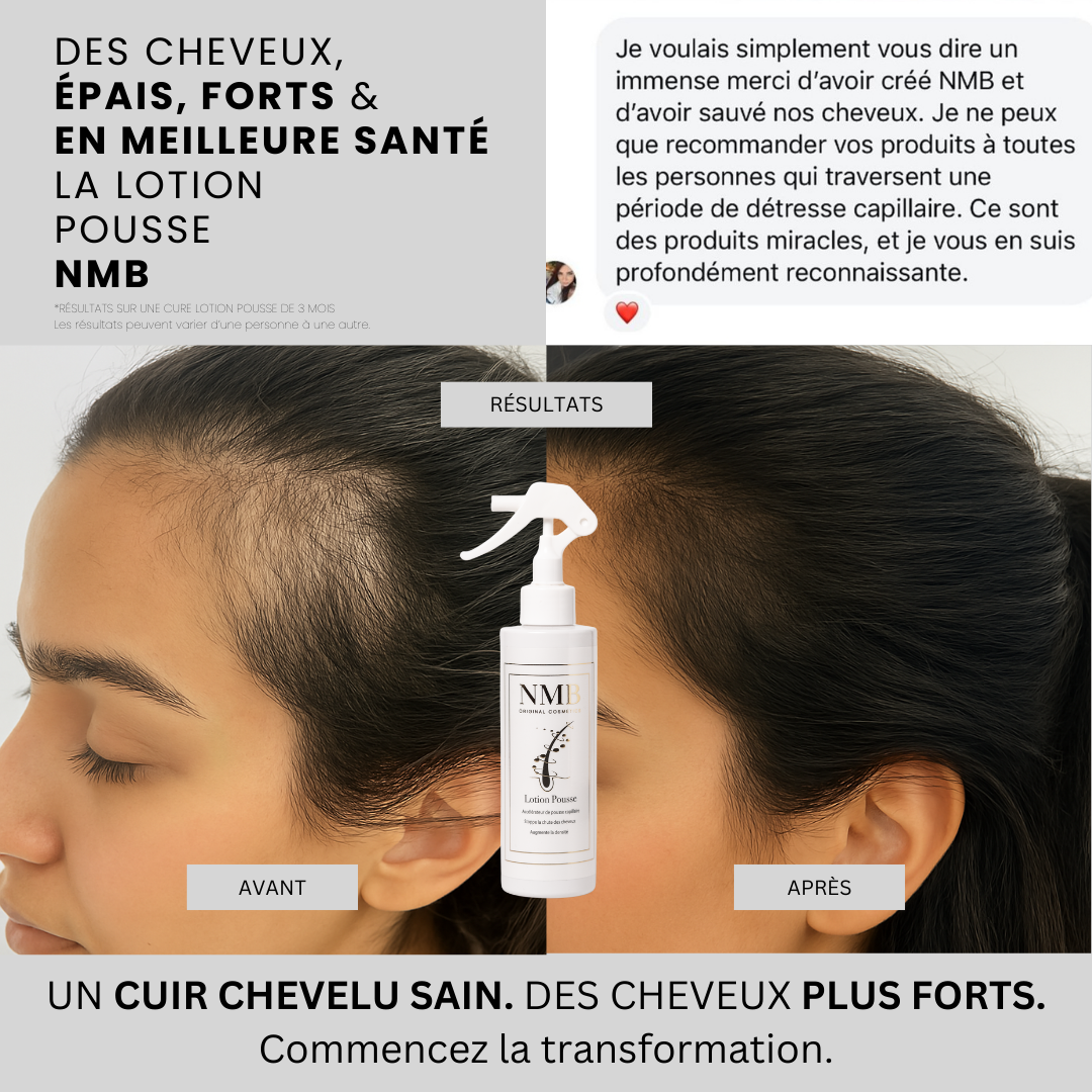 Avant / après de la ligne frontale d'une cliente avec la Lotion Pousse NMB et son message de remerciement