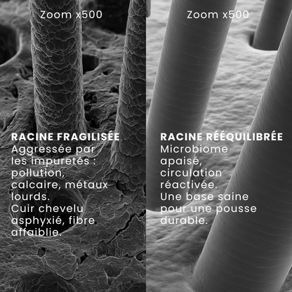 STIMULI SCALP – Shampoing stimulant à la Biotine