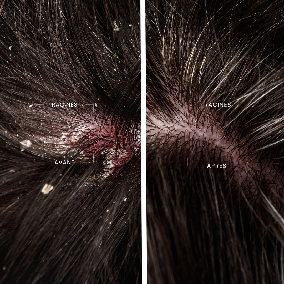 Shampoing Activateur Détox