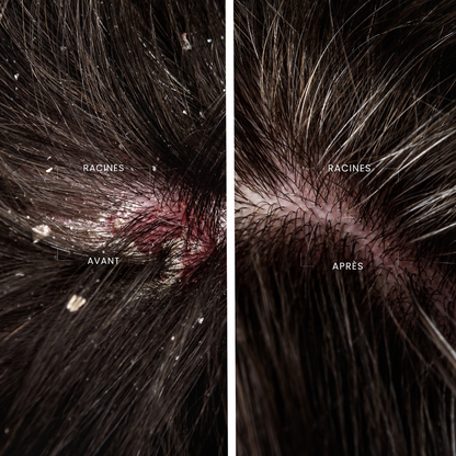 Shampoing Activateur Détox