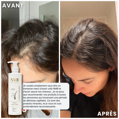 STIMULI SCALP – Shampoing stimulant à la Biotine