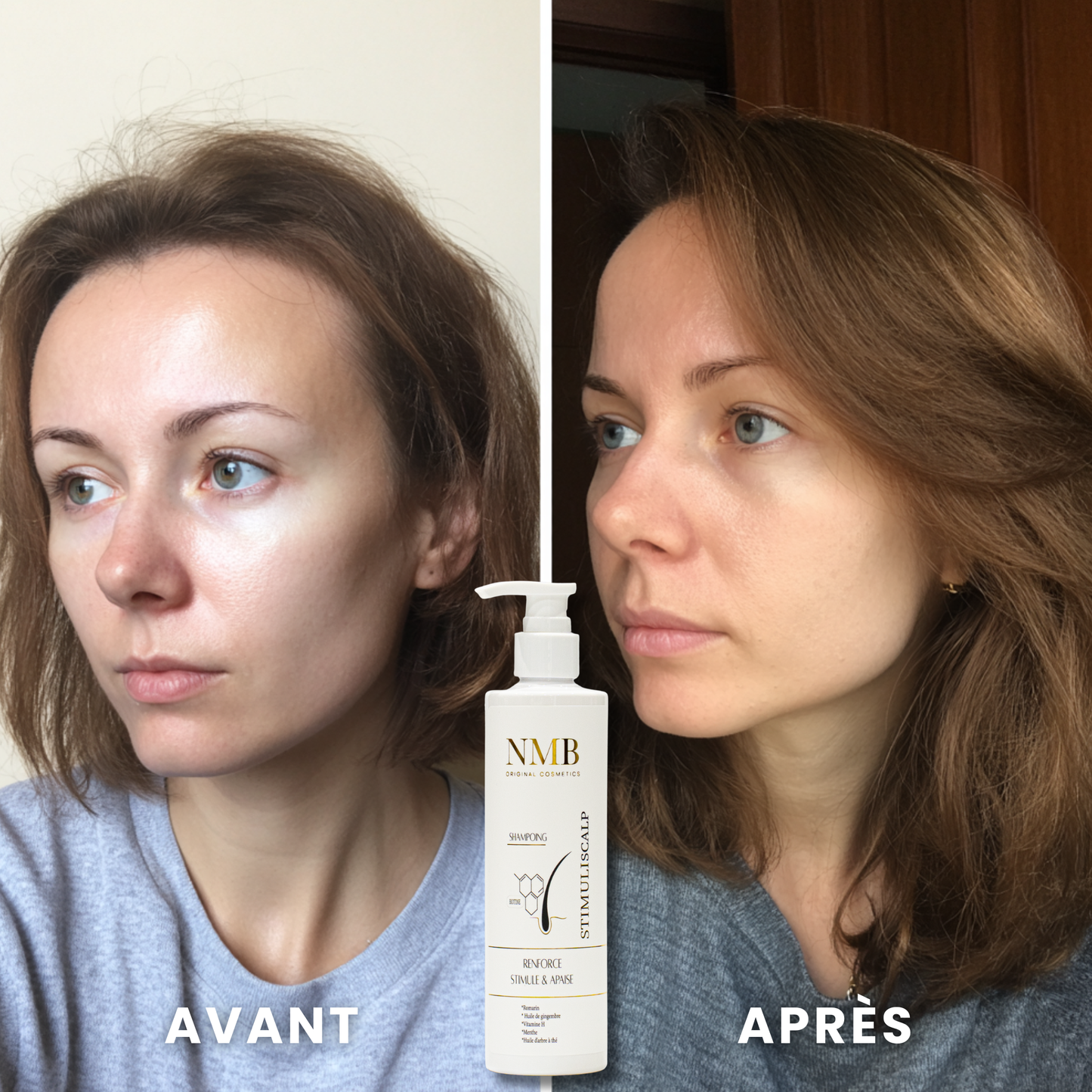 STIMULI SCALP – Shampoing stimulant à la Biotine