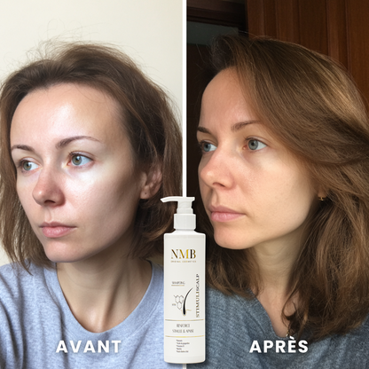 STIMULI SCALP – Shampoing stimulant à la Biotine