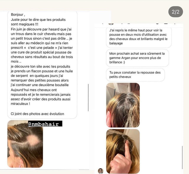 Message privé · pelade · Lotion Pousse + Huile de serpent