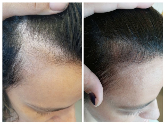 Avant / après · golfes et tempes